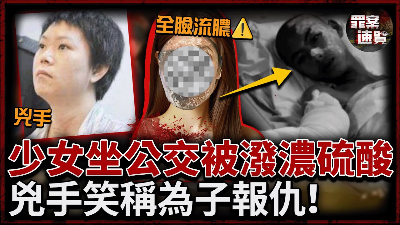 18歲少女坐公交被潑硫酸，全臉燒傷流膿！兇手靠着門欣賞慘叫：這是你全家欠的債！｜罪案速覽