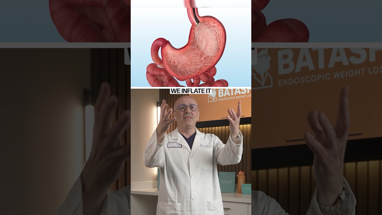 How The Gastric Balloon Procedure Is Performed