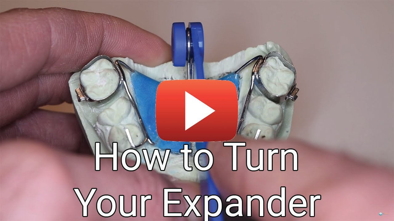 How to Turn Your Expander