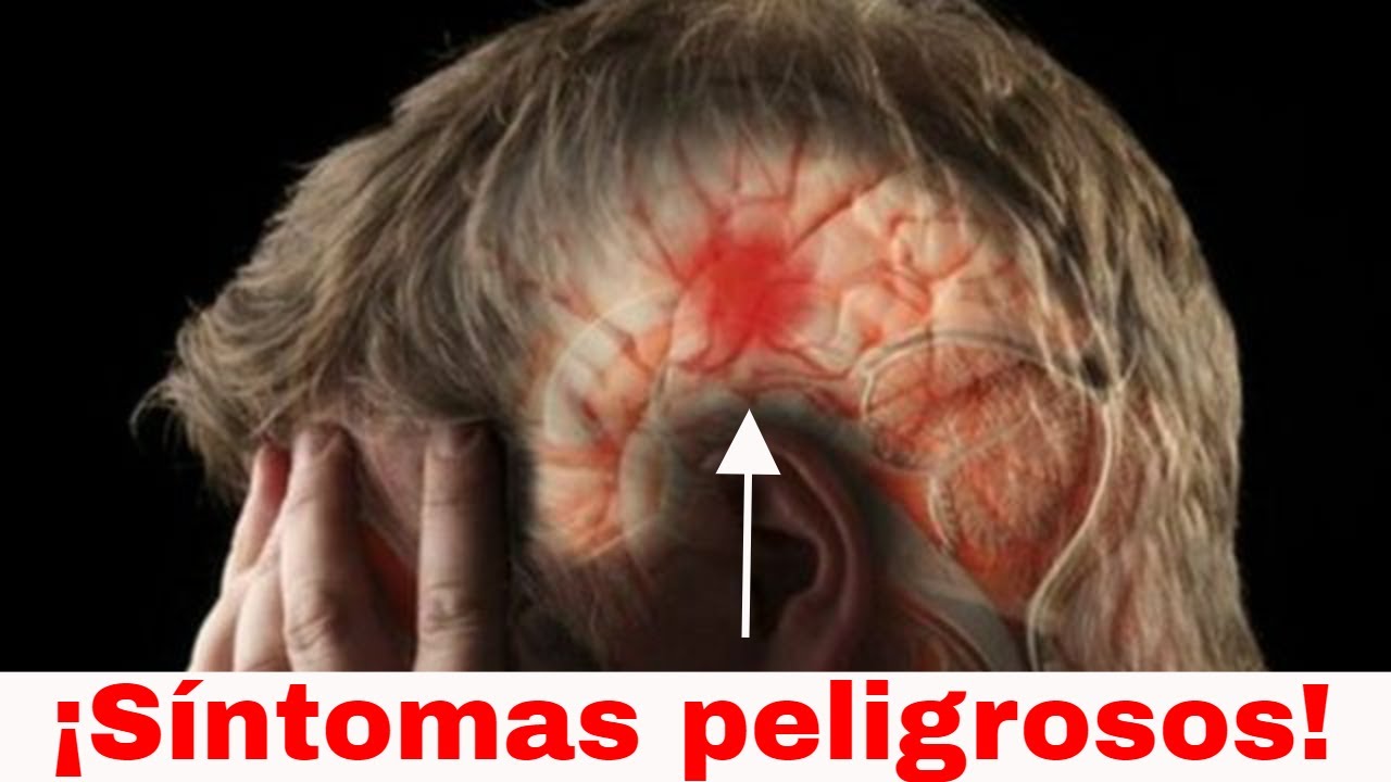 10 señales de que tu dolor de cabeza es peligroso
