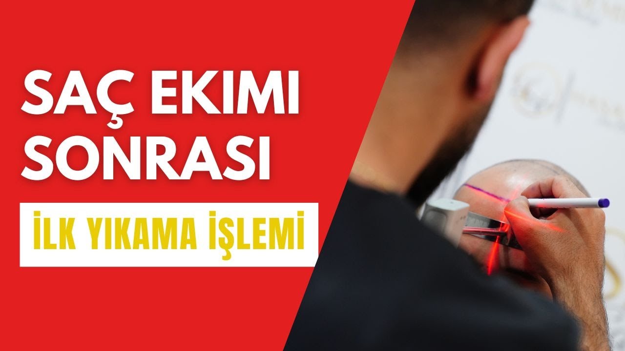 SAÇ EKİMİ SONRASI İLK YIKAMA İŞLEMİ