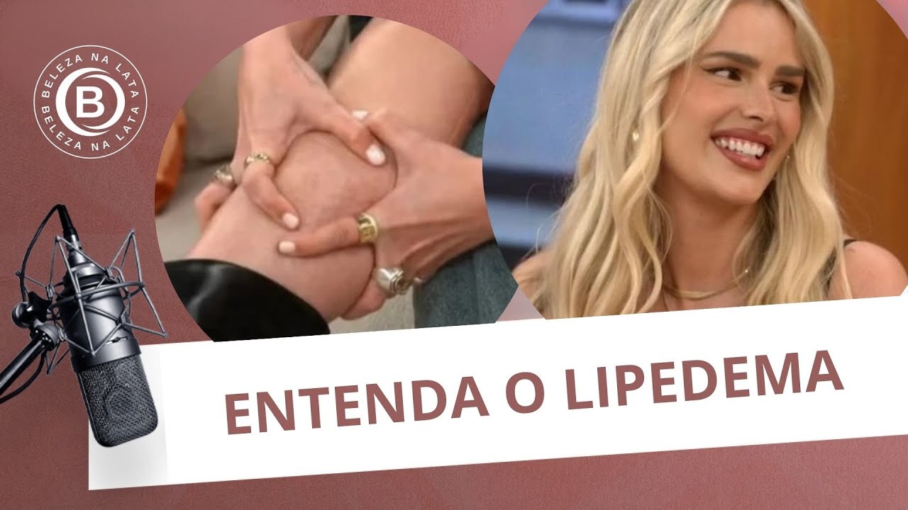 YASMIN BRUNET REVELOU O LIPEDEMA, ENTENDA ESSA PATOLOGIA  | BELEZA NA LATA #52