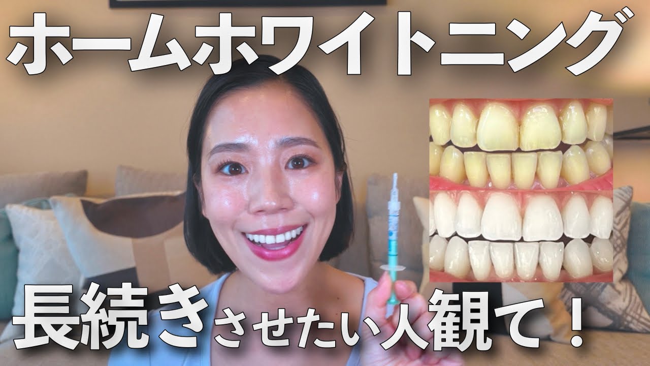 【白い歯】この一手間で違う！白さが続くホワイトニング方法