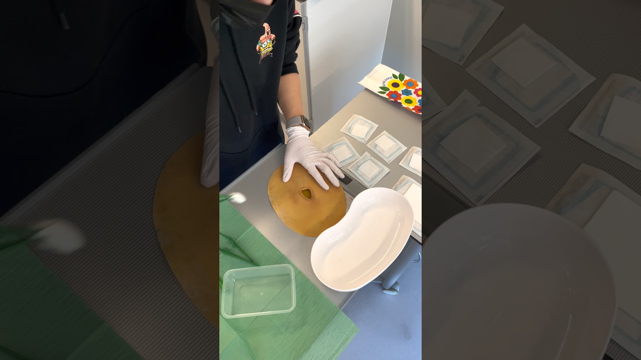Gele wond verzorgen