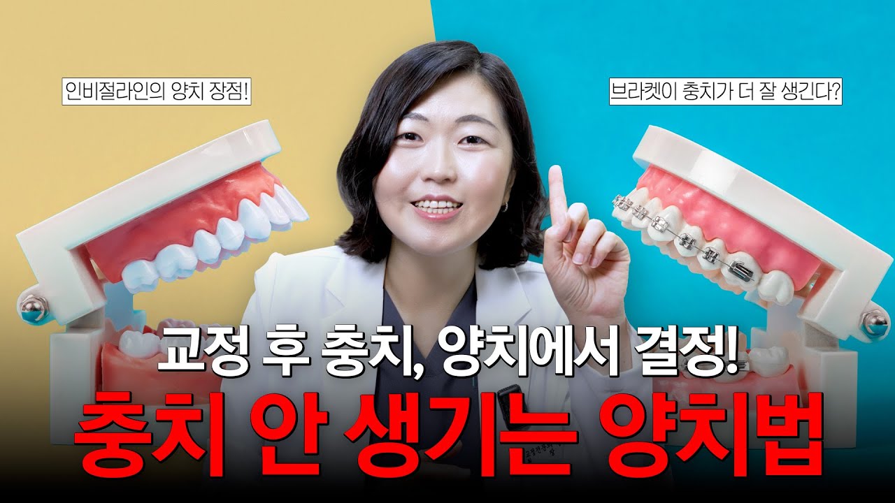 교정 후 충치, 양치에서 결정! 충치 안 생기는 양치법👀
