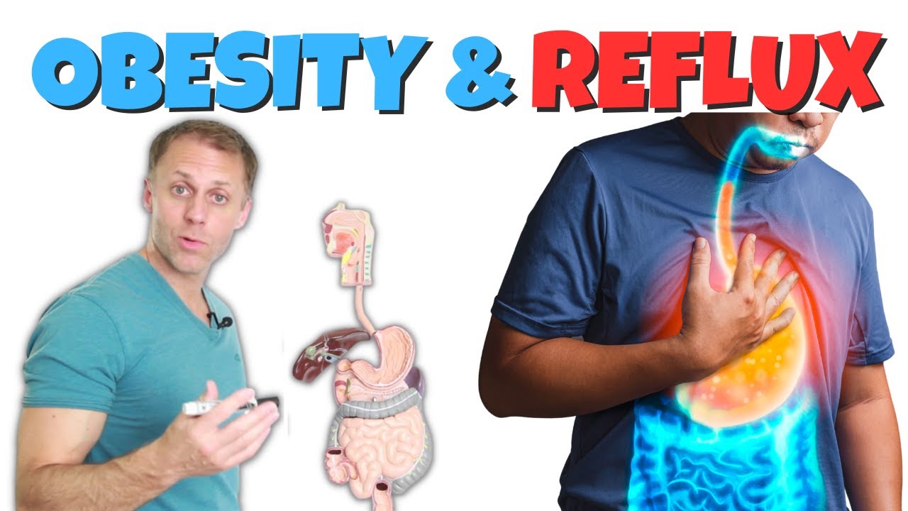 Obesity and Acid Reflux or GERD