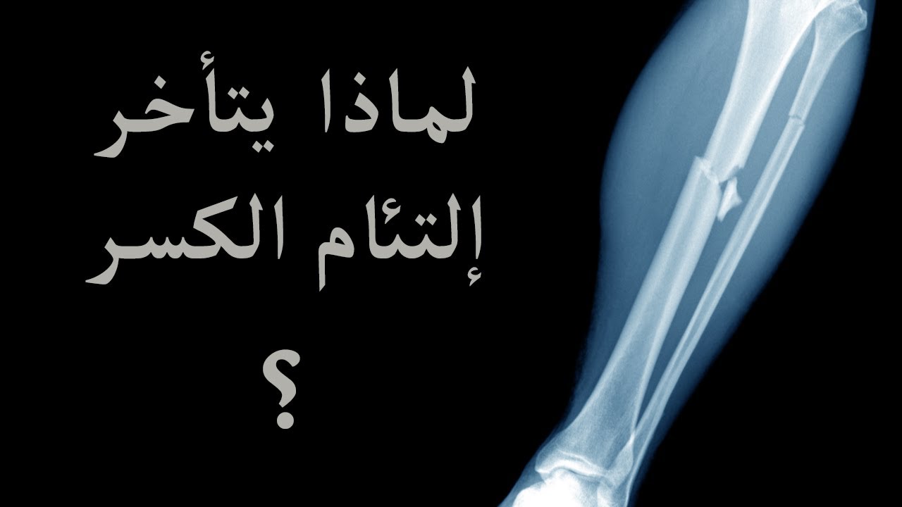 تأخر التئام الكسور