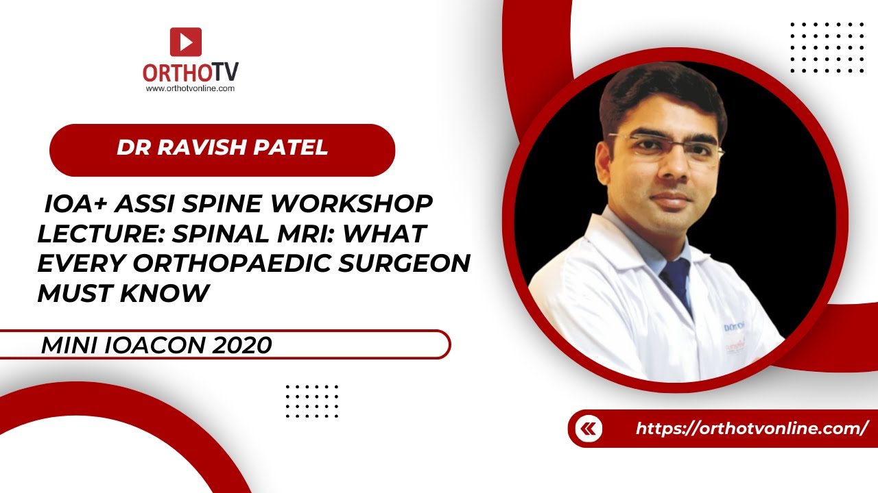 Lecture: Spinal MRI: What every Orthopaedic surgeon must know - Ravish Patel