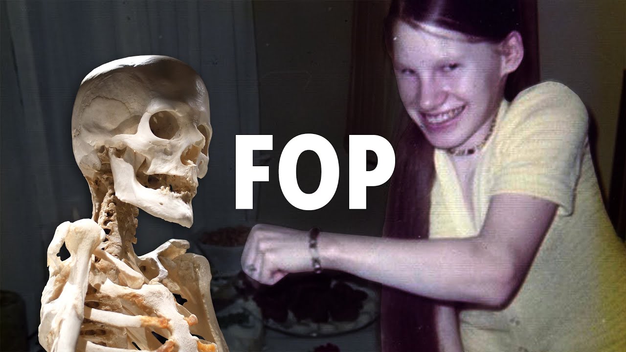 The Disease That Grows Extra Bones (Carol Orzel Birthday Video)