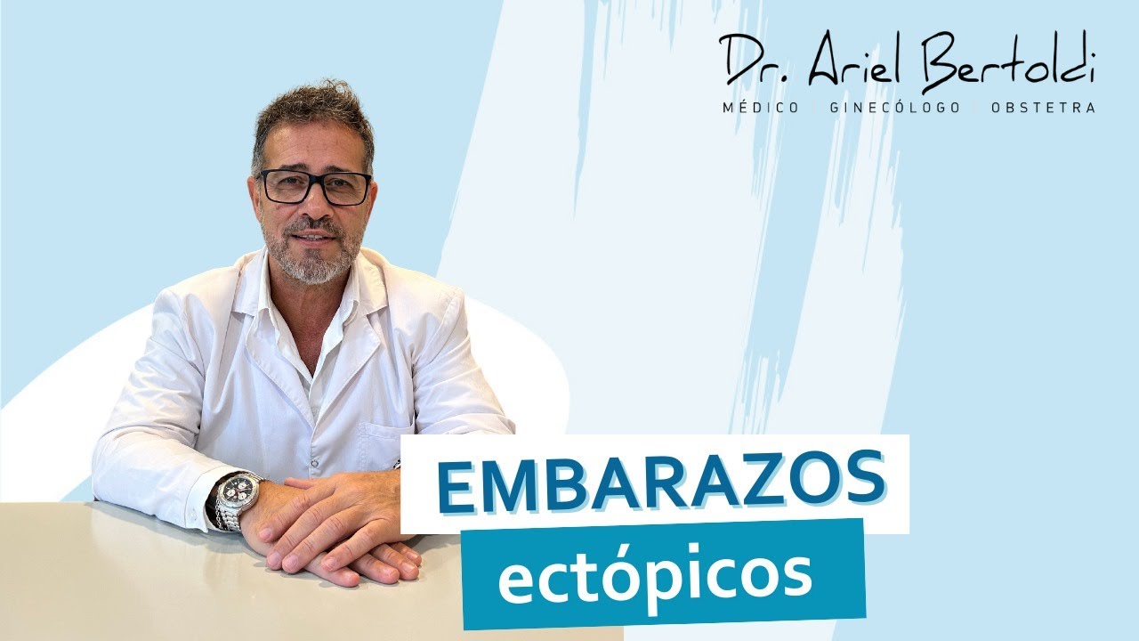 ¿Qué es un Embarazo Extrauterino? ¿Es lo mismo ECTÓPICO? Tipos, Causas y Cómo Detectarlo a Tiempo
