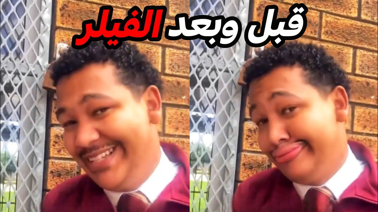 يحرك شفايفه بطريقة غريبة وسوا فيلر طبيعي!!