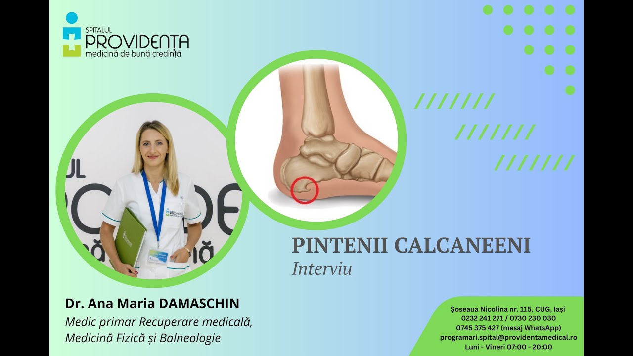 Pintenii calcaneeni - dr Ana Maria Damaschin