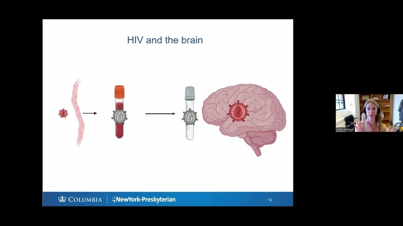 SMART University: General Brain Health & HIV