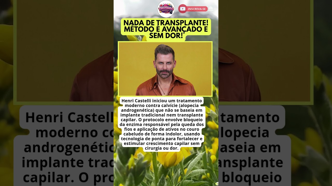 HENRI CASTELLI REVELA TRATAMENTO TECNOLÓGICO E INDOLOR CONTRA CALVÍCIE