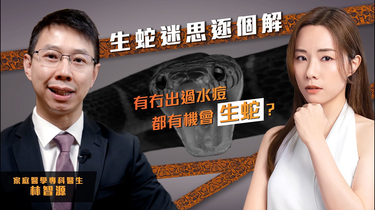 生蛇迷思逐個解｜家庭醫學專科林智源醫生 【有冇出過水痘都有機會生蛇？】