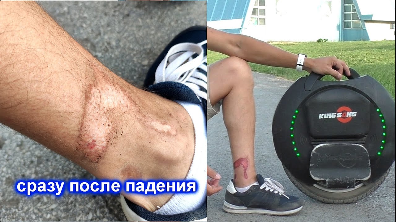Про трамвы на моноколесе которые вы получите пока учитесь кататься на моноколесе