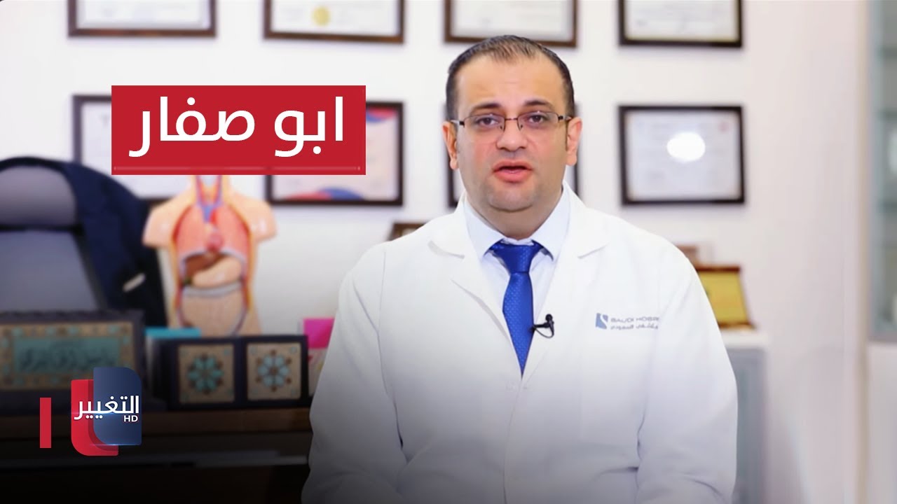معلومات غريبة عن اليرقان