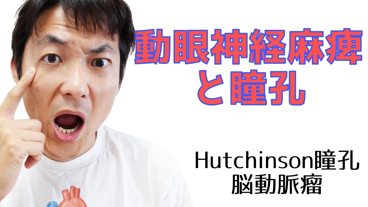 Hutchinson瞳孔と脳動脈瘤による瞳孔不同：瞳孔(Part.７)