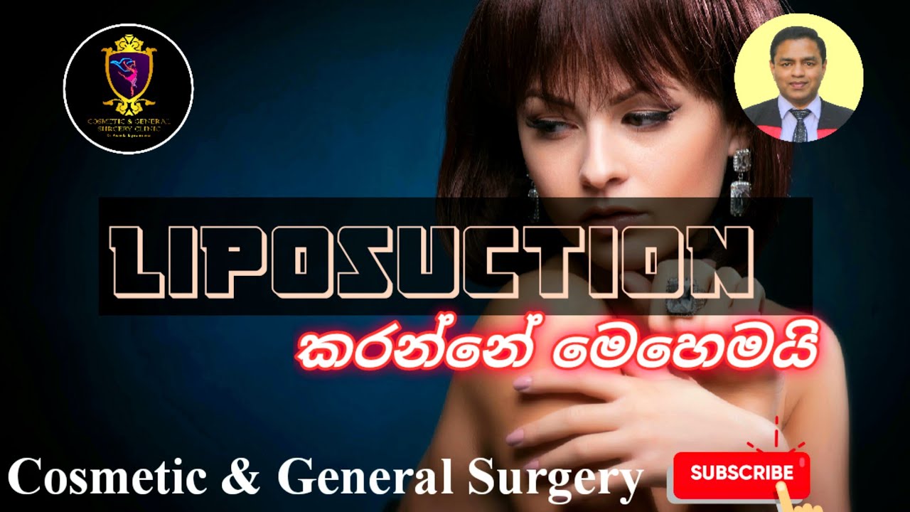 Liposuction ලයිපොෂක්සන් Belly fat උදරයේ තෙල් ඉවත් කිරීම Dr Ananda Jayawardena Cosmetic and General