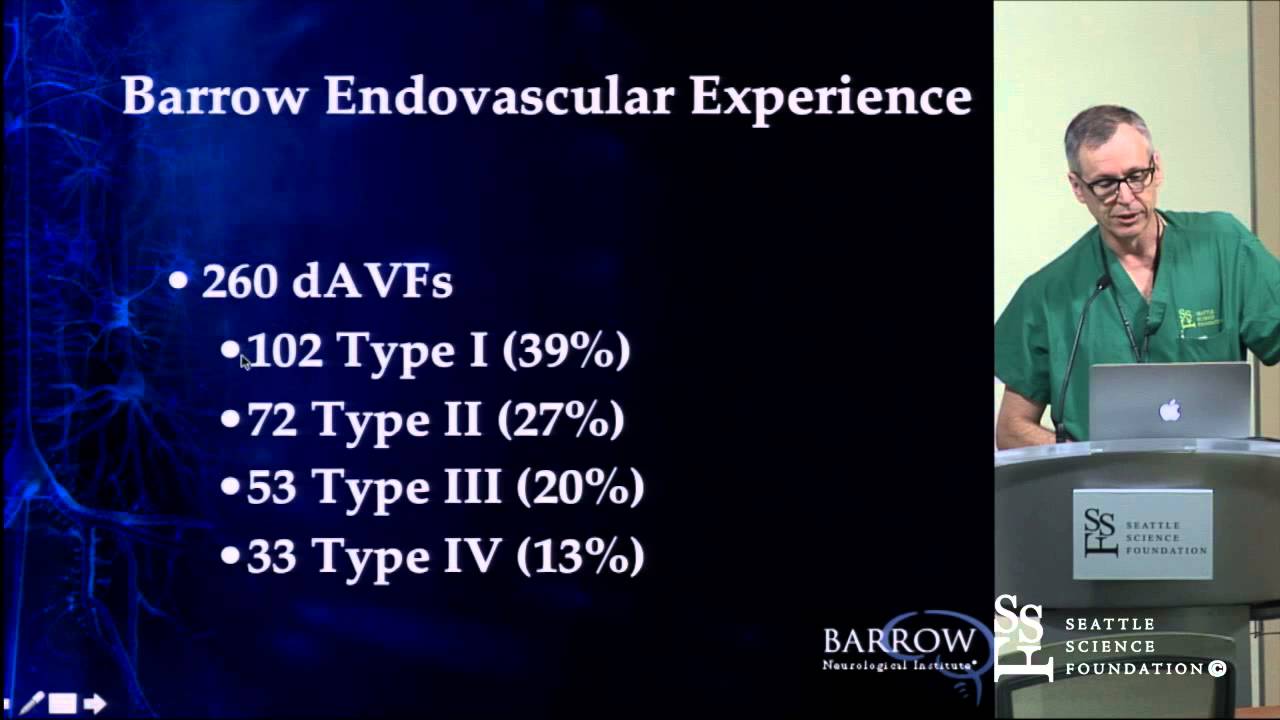 Treatment of Dural Arteriovenous Fistulas by Cameron McDougall, M.D.
