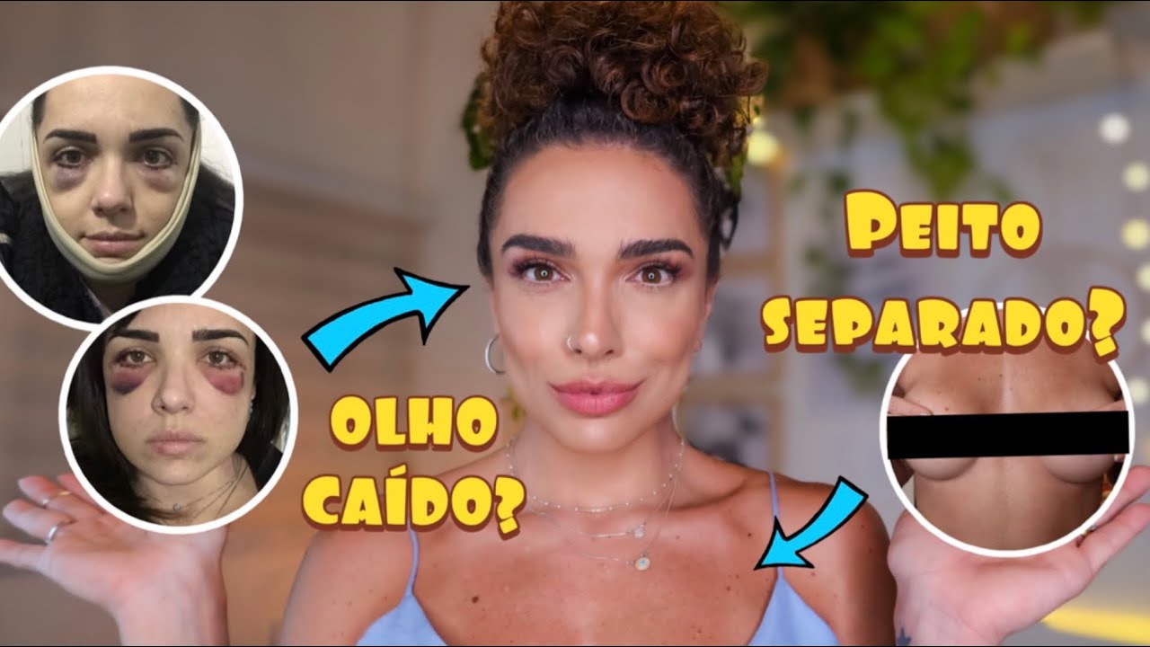 MINHAS CIRURGIAS PLÁSTICAS | silicone e blefaroplastia #JujuResponde | por Juliana Franceschi