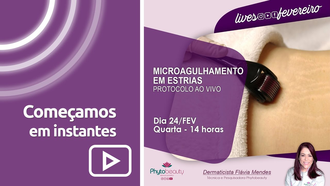 Microagulhamento em Estrias - Live 24/02/2021