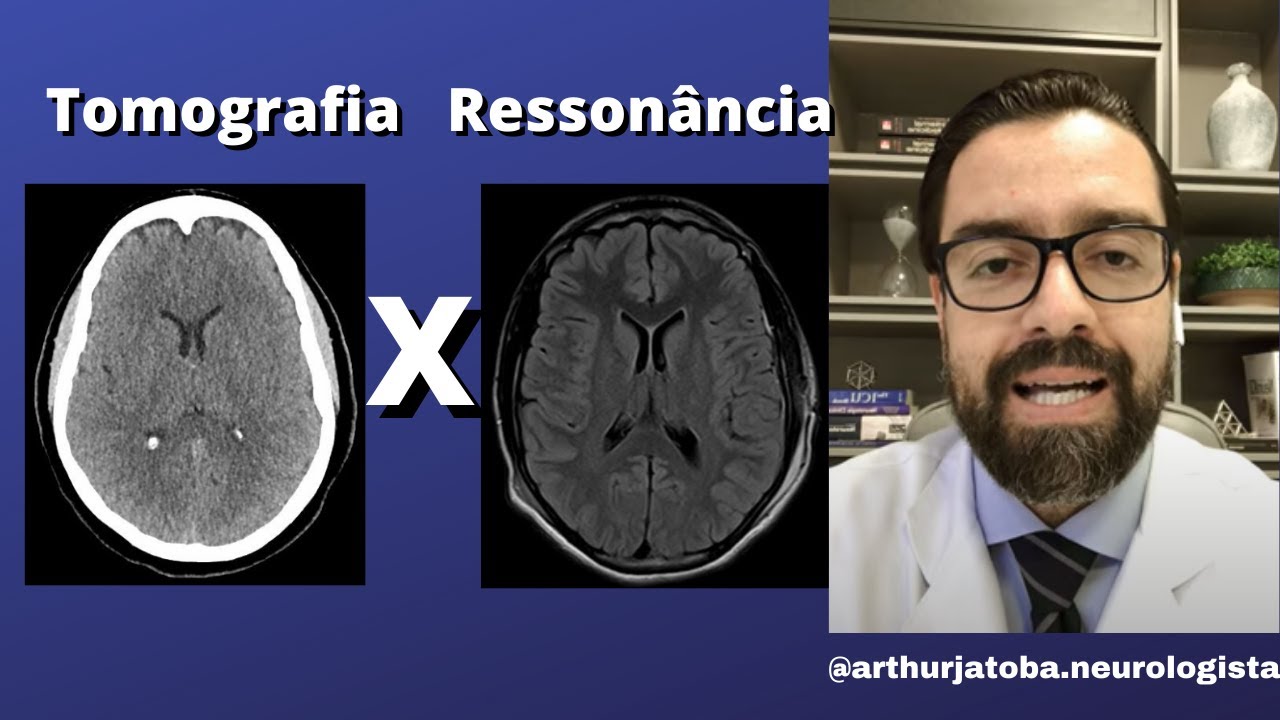 DIFERENÇA ENTRE RESSONANCIA MAGNETICA E TOMOGRAFIA