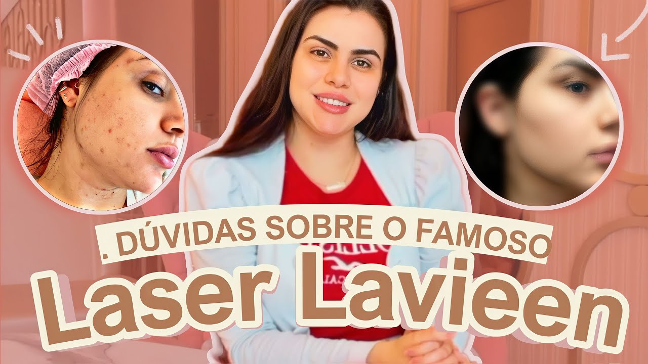 Meu resultado de laser Lavieen, será que ficou bom? Venha conferir.