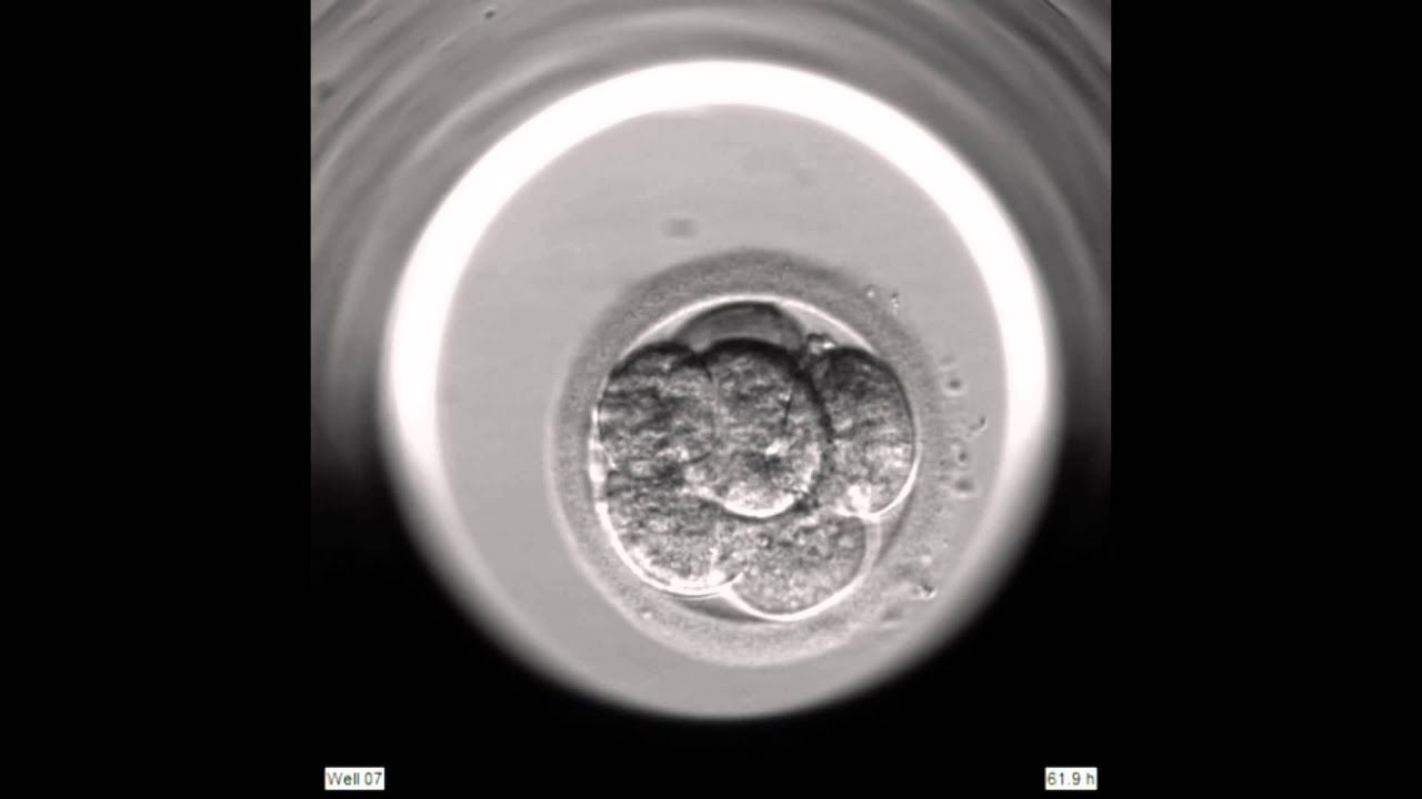 EmbryoScope Embryo Development - Blastocyst