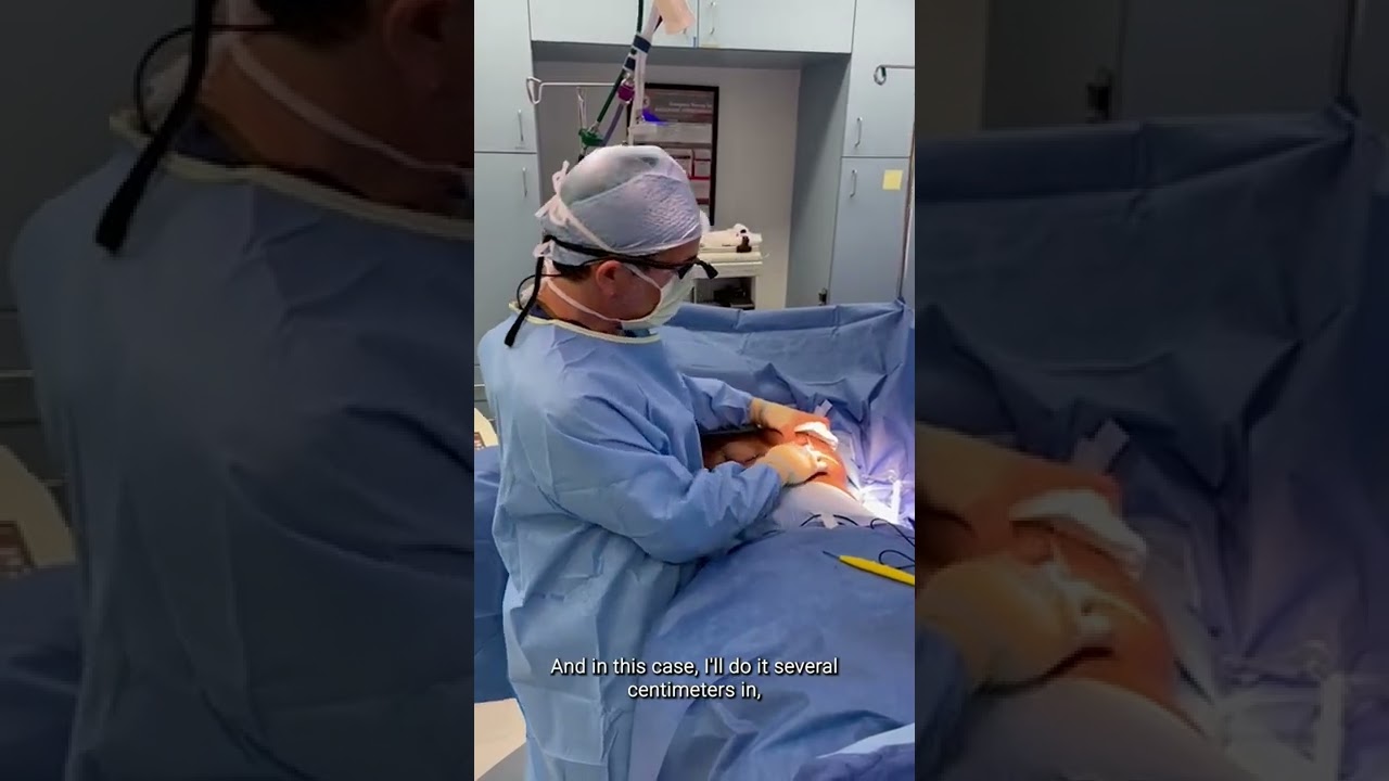 In The OR: Incisions During Breast Lift & Explant | Dr. Kevin Brenner