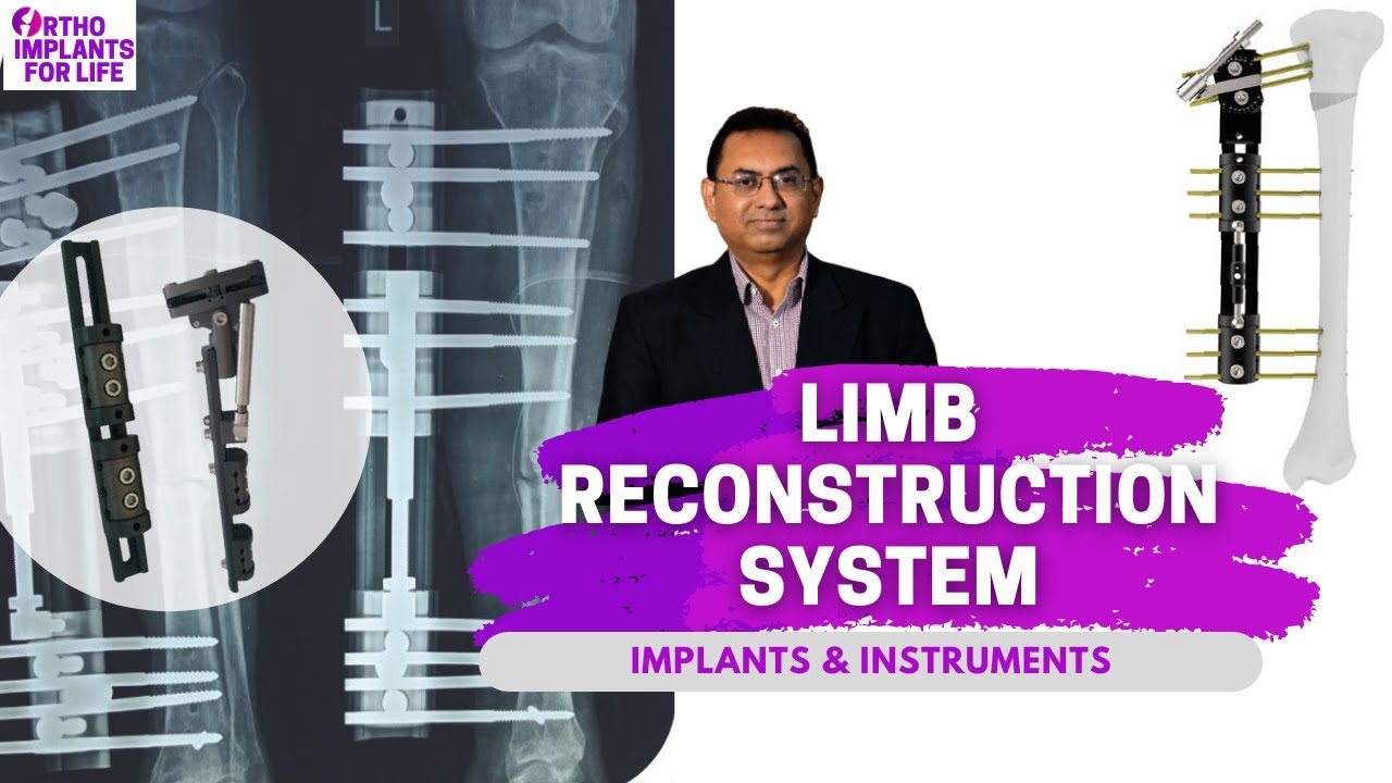 Limb Reconstruction System | LRS | Implants and Instruments