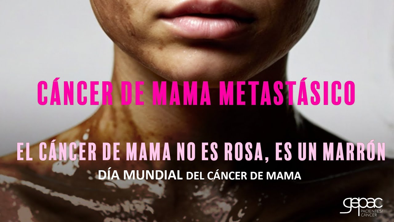 Cáncer de mama metastásico