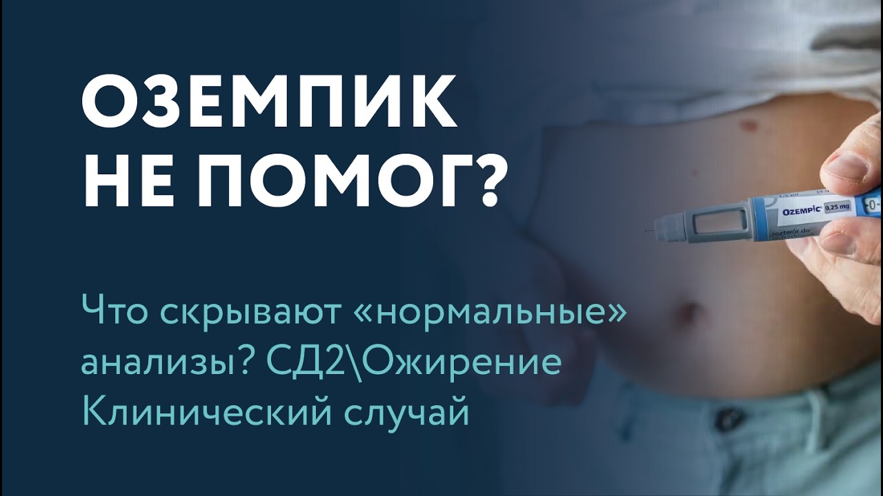 ОЗЕМПИК НЕ ПОМОГ? Что скрывают &ldquo;нормальные&rdquo; анализы? Клинический случай СД2\Ожирение