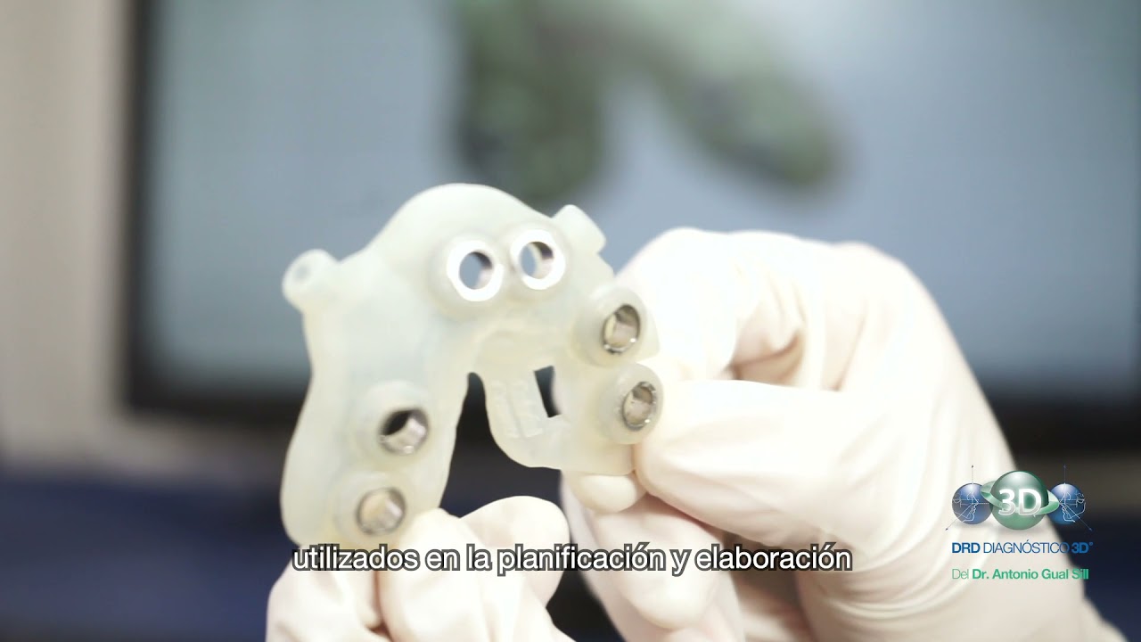 🖥 Modelos Digitales con Tecnología 3Shape, en 🟢 DRD Diagnóstico 3D