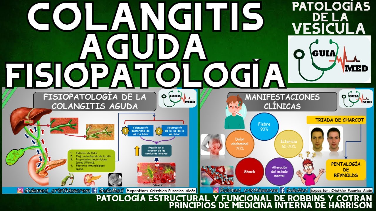 COLANGITIS FISIOPATOLOGÍA | GuiaMed