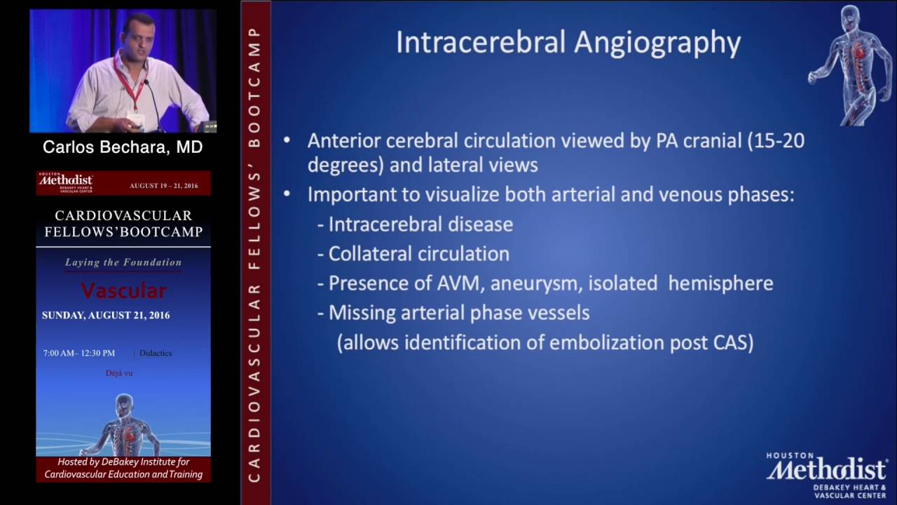 Endovascular Management of Carotid and Vertebral Stenosis (Carlos Bechara, MD)