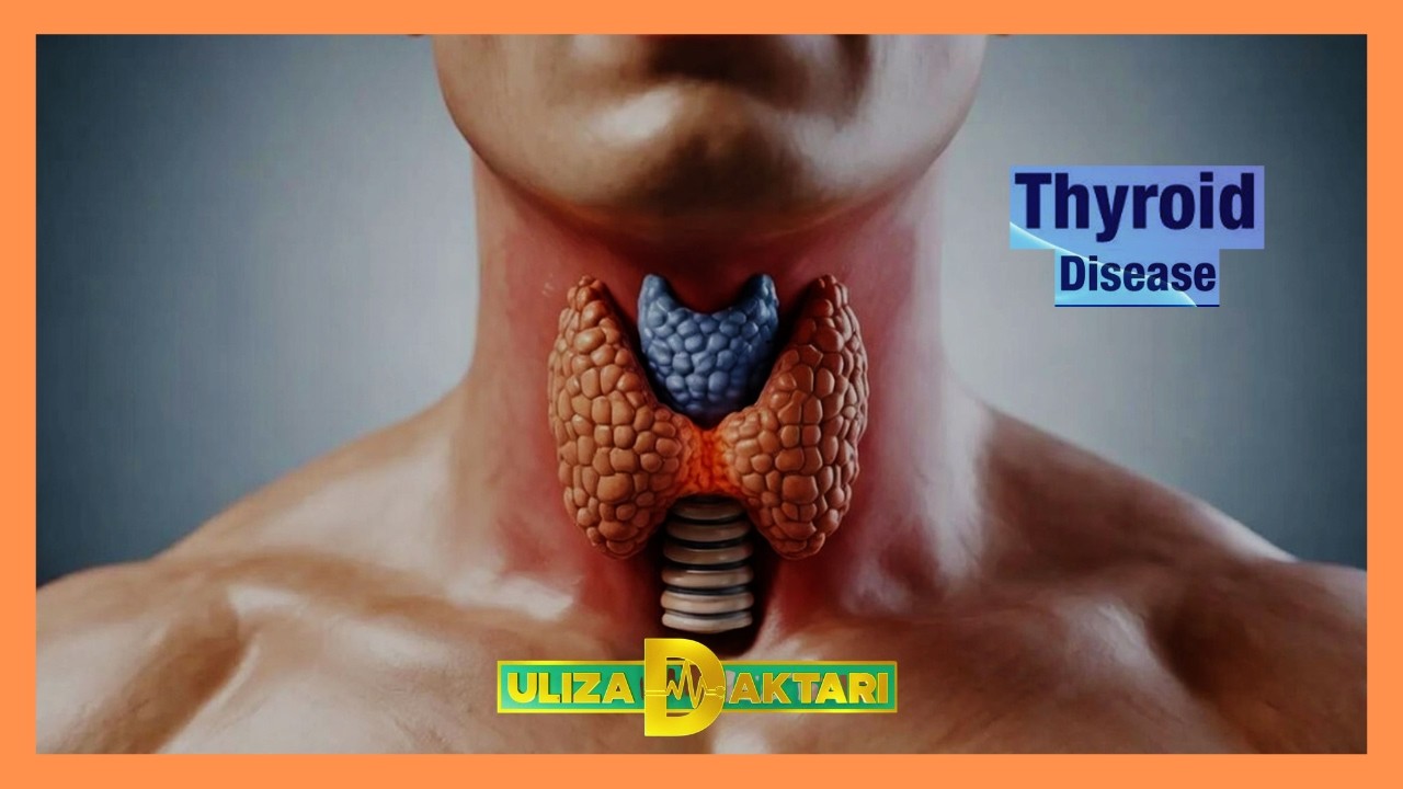 Uliza Daktari | Understanding Thyroid gland disorders | Part 3