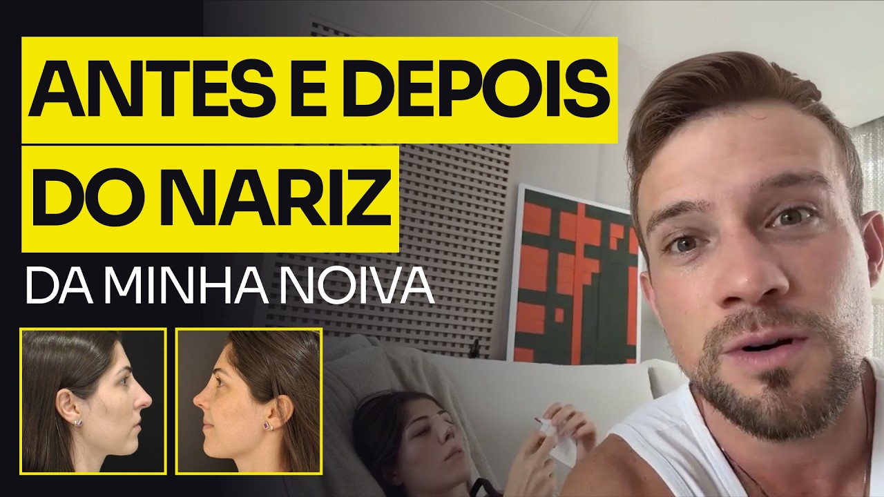 COMO FICOU O NARIZ DA LARISSA: REAÇÃO DELA AO RESULTADO