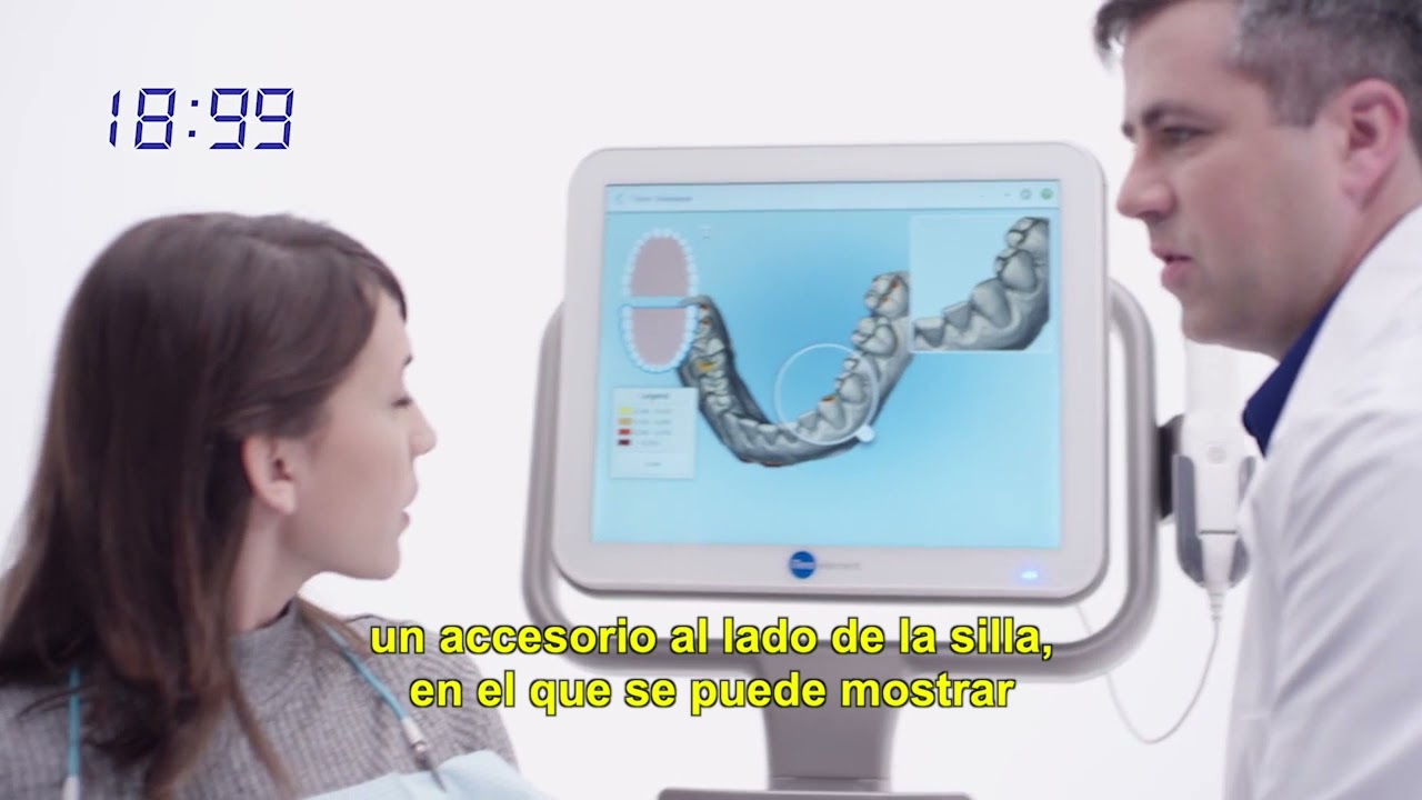 Consulta en tiempo colapsado