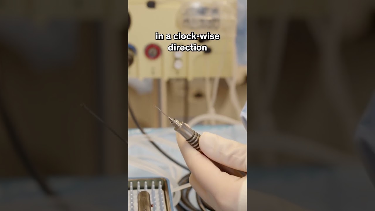 Learn how to fit reusable phaco tips - for cataract surgeons #shorts #cataract #surgeonslife