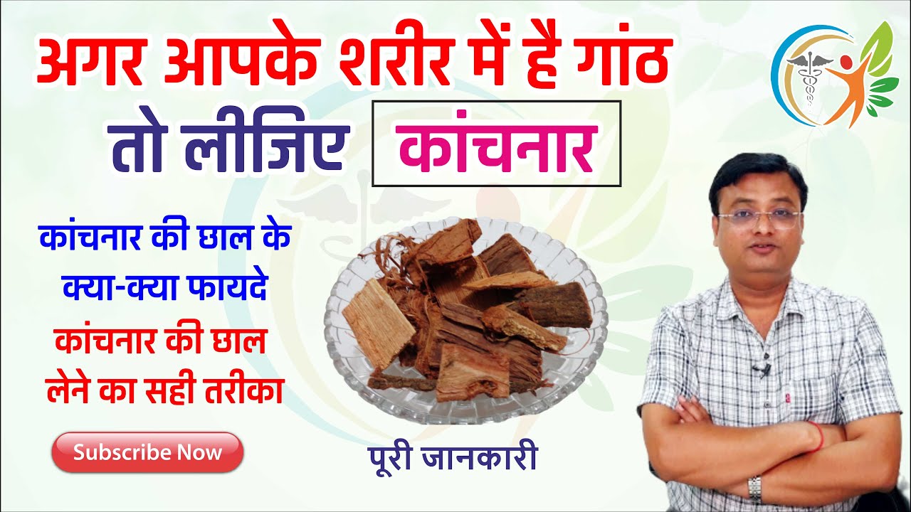 कांचनार की छाल के फायदे | गांठ में कांचनार की छाल कैसे प्रयोग करे | Dr. Prateek Agrawal (0044)