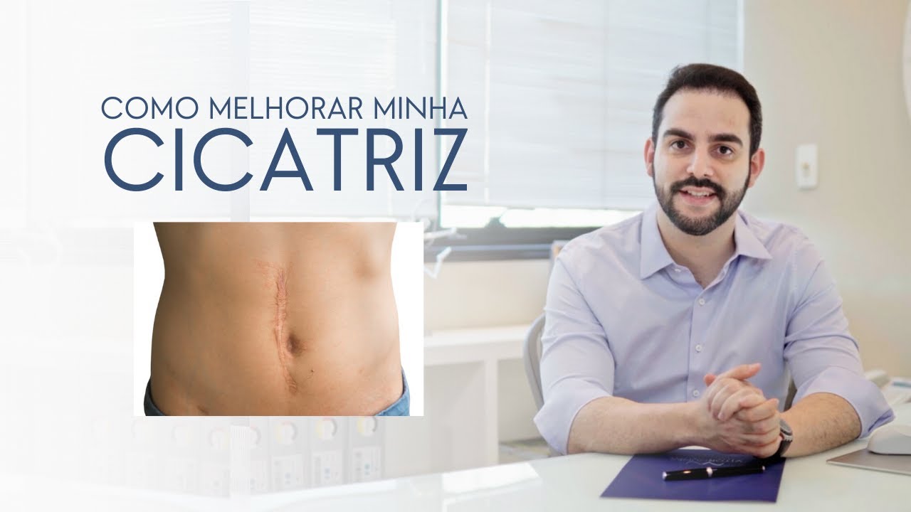 Quero melhorar minha CICATRIZ, é possível? Saiba tudo sobre refinamento de cicatriz.