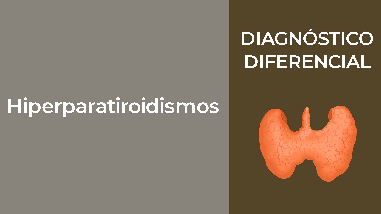 Diagnóstico Diferencial. Hiperparatiroidismos