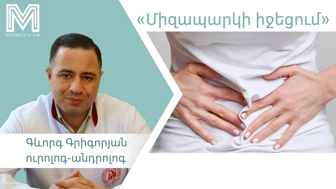Երեք խորհուրդ բժշկից․«միզապարկի իջեցում»