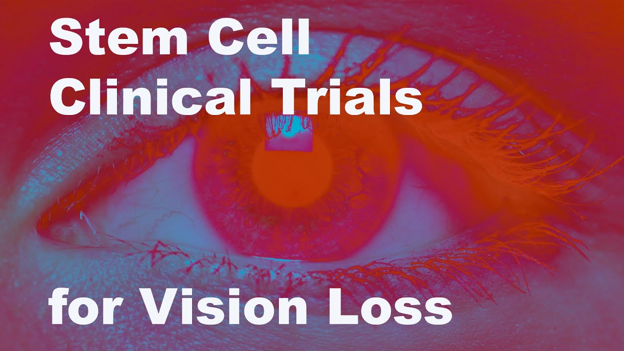 Stem Cells in Your Face - Episode 3: Eyeing Stem Cell Therapies for Vision Loss