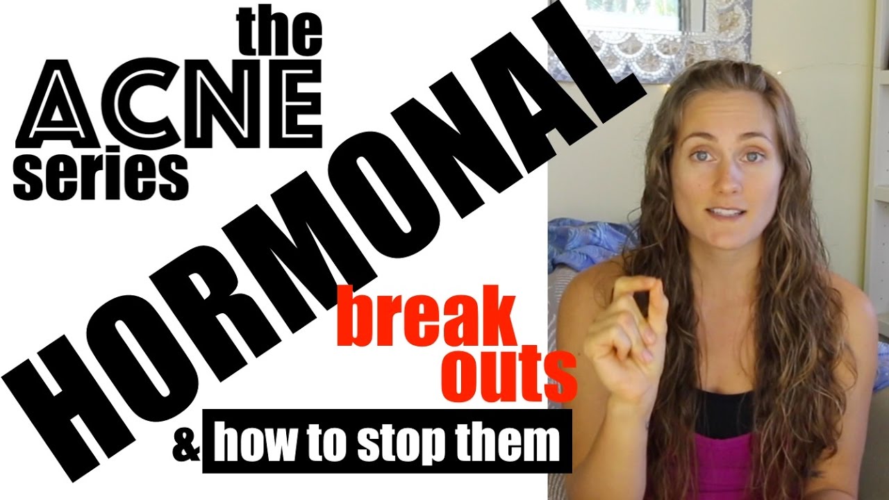 Hormonal Acne - Stop the Monthly Breakouts! The Acne Series