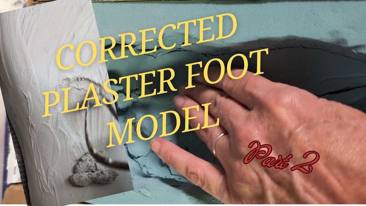 Corrected Plaster foot Model, Part 2