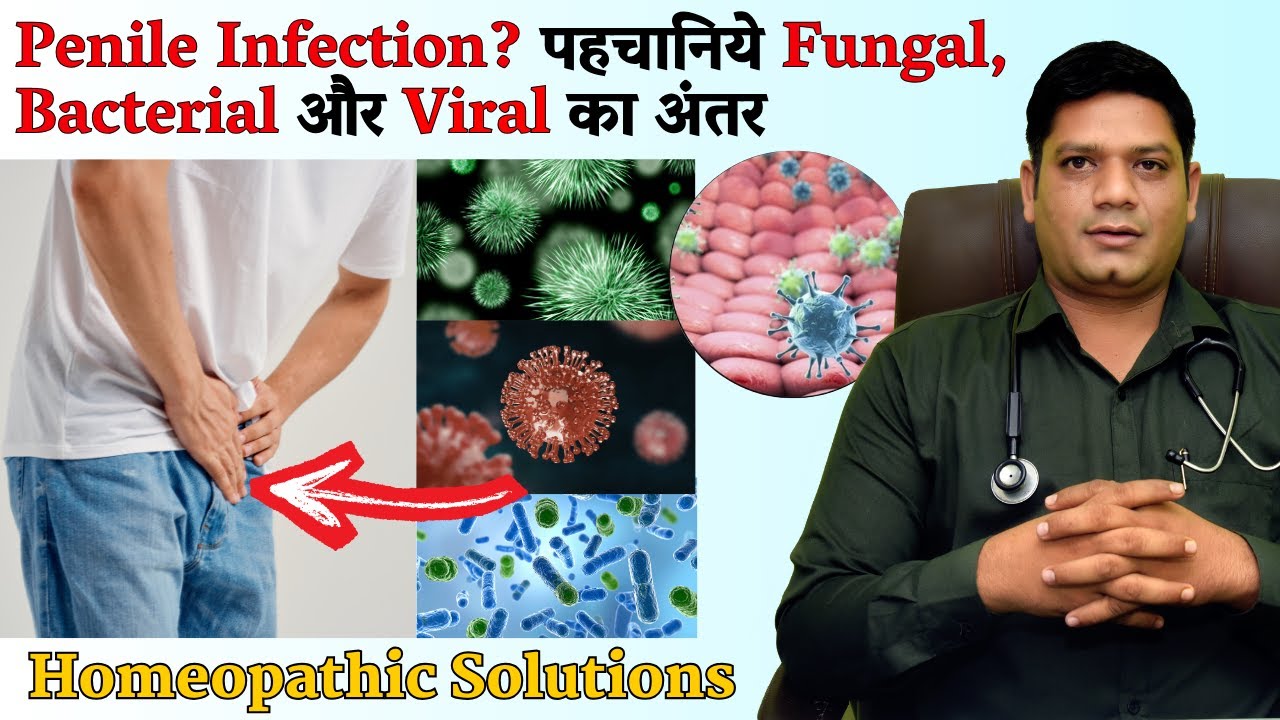 Recognize the Difference Between Fungal, Bacterial, and Viral Penile Infection? | Dr Sunil Patidar