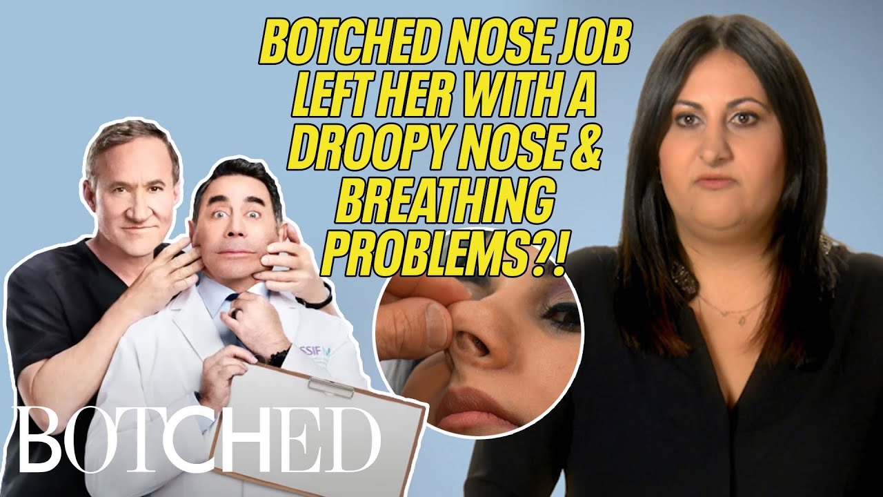 Pardis Had a BOTCHED Nose Job Leaving Her With Breathing Problems!? | Botched | E!