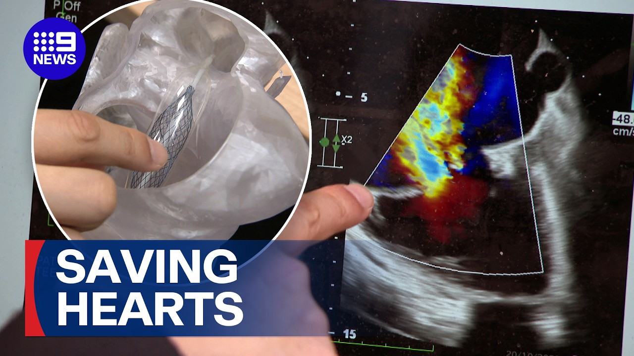 World-first trial to fix failing hearts | 9 News Australia